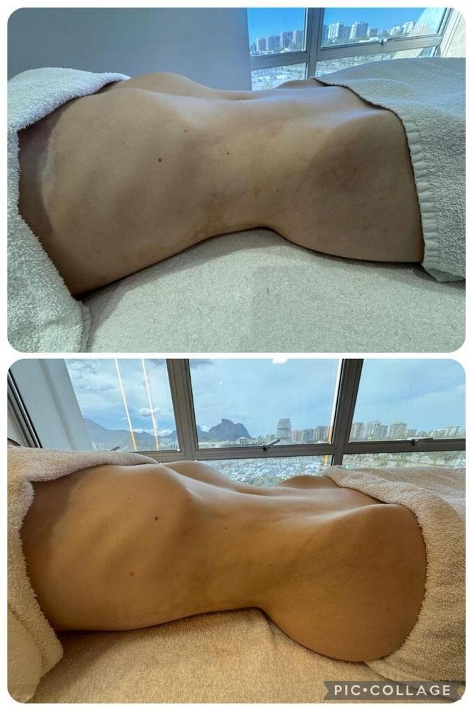 Resultado Abdômen — Santoli Clinic Care