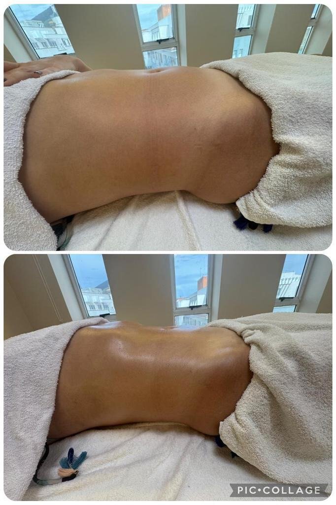 Resultado Lombar — Santoli Clinic Care